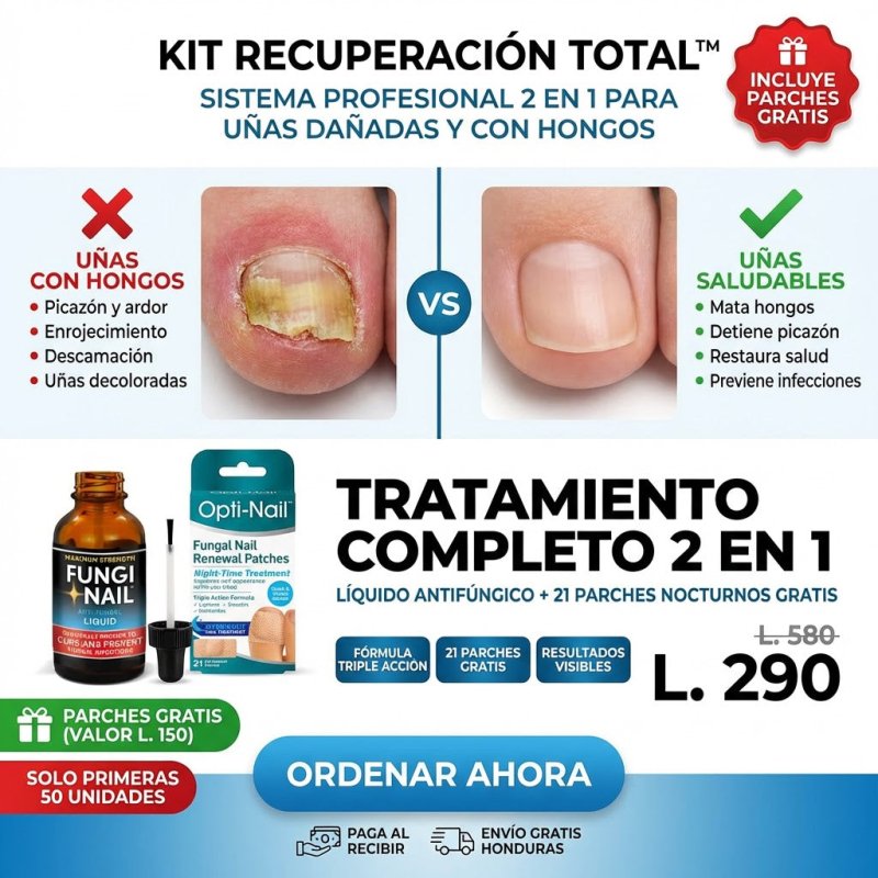 KIT RECUPERACIÓN TOTAL™ Sistema Profesional 2 en 1 para Uñas Dañadas y con Hongos Onicomicos GARANTÍA Y CERTIFICACIÓN MEDICA INCLUIDA - Inversiones Alkosto